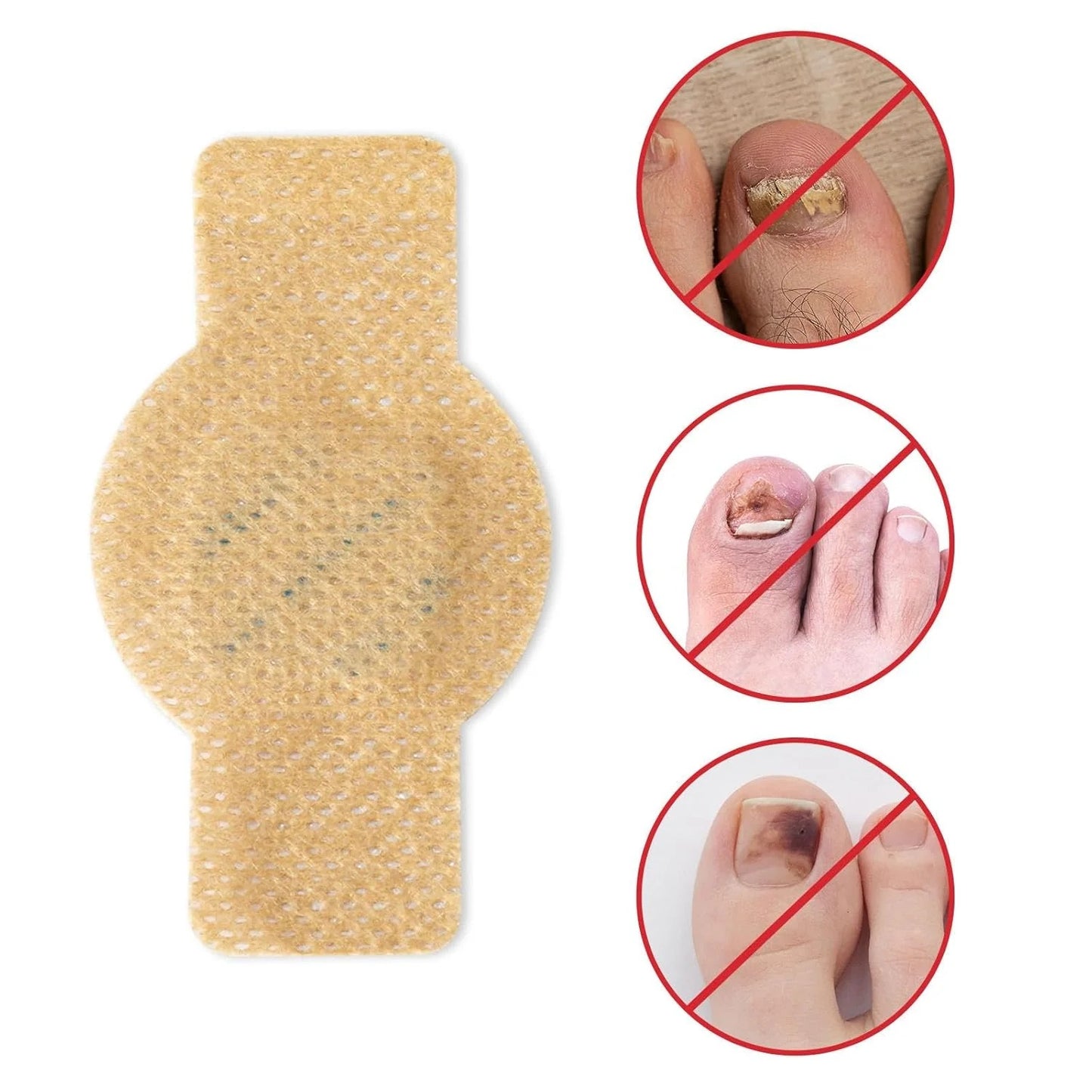 NailHeal™ - Fungal Nail Patches 🌿💅 ( Buy 1 Get 1 Free🔥🔥) Regular price