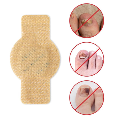 NailHeal™ - Fungal Nail Patches 🌿💅 ( Buy 1 Get 1 Free🔥🔥) Regular price