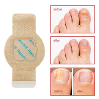 NailHeal™ - Fungal Nail Patches 🌿💅 ( Buy 1 Get 1 Free🔥🔥) Regular price - Image 5